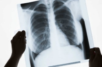 Рентгенография костей и суставов
